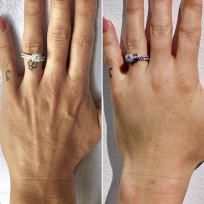 YouthLift Crema Mani al Retinolo